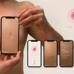 Рак молочной железы: как проверить свою грудь через приложение на мобильном телефоне