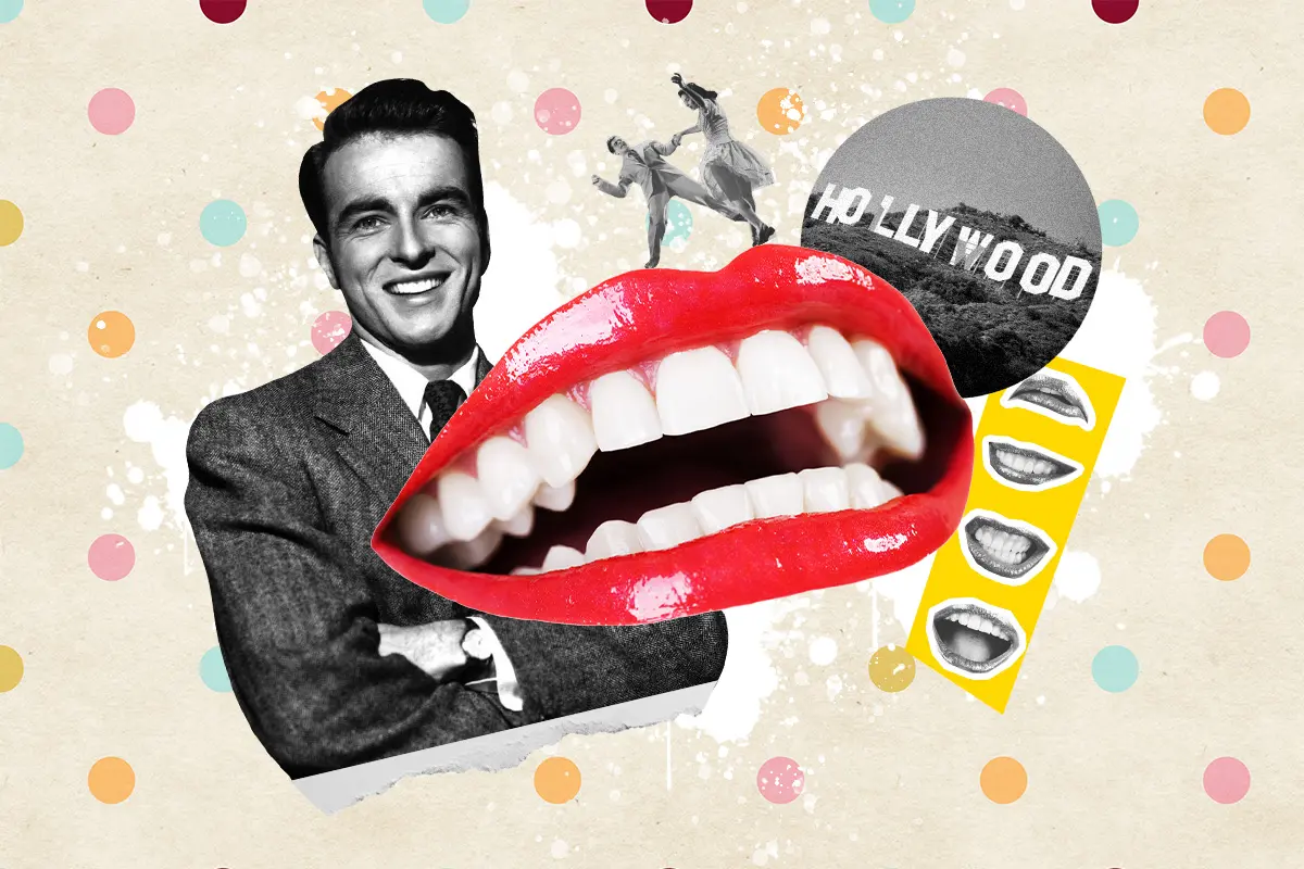 Что такое виниры: история "голливудской улыбки" и плюсы/минусы установки