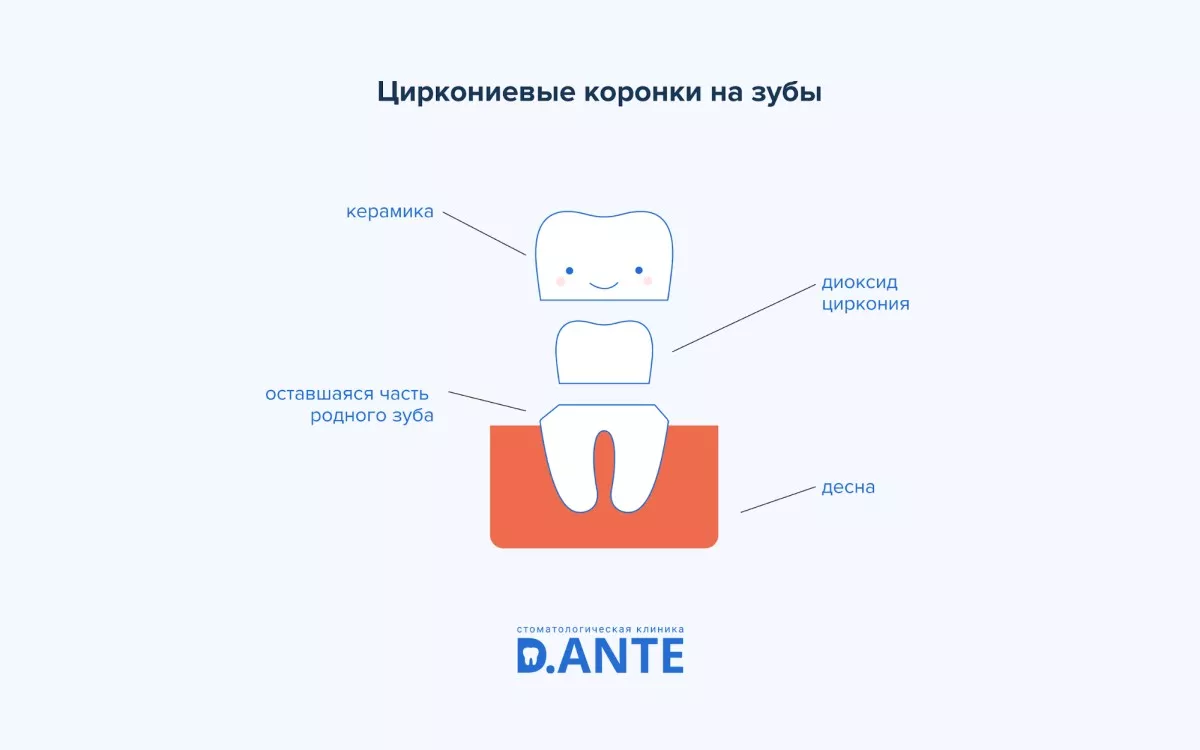 Коронки на зуби: показання, види, вартість 