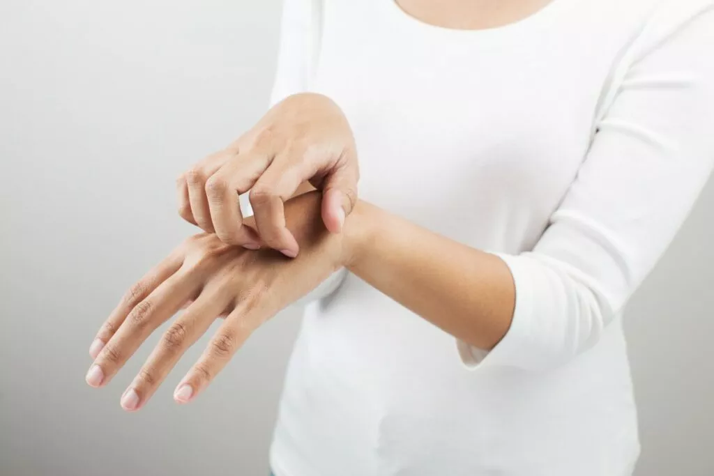Аллергия на руках: причины, симптомы и лечение