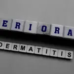 Періоральний дерматит: що це таке і чому виникає