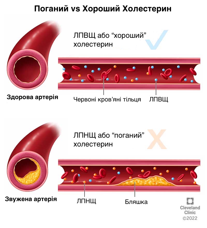 Типи холестерину