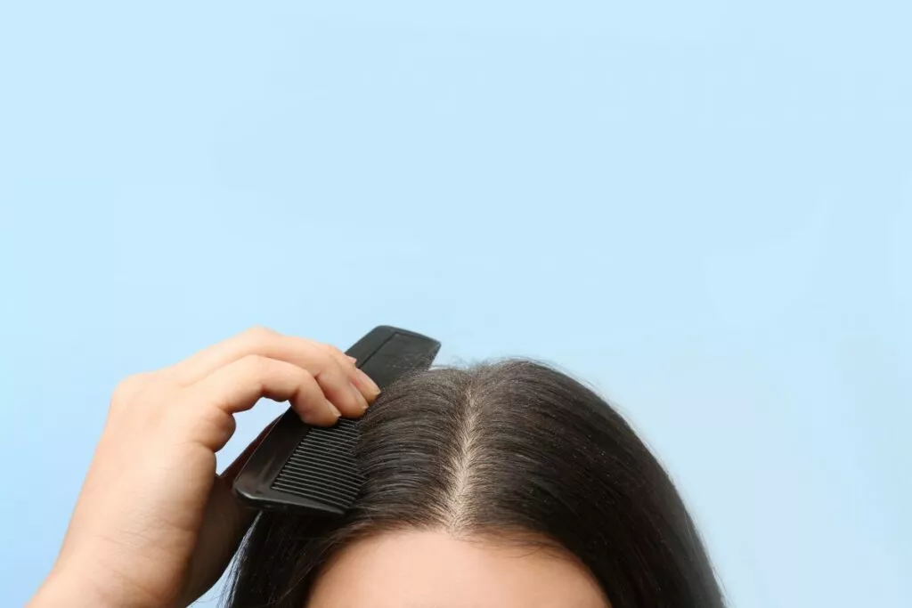 Как увлажнить кожу головы и улучшить состояние волос